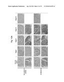 REAGENT INCLUDING ANTI-LGR6 ANTIBODIES FOR DETECTION AND DIAGNOSIS OF     CANCER diagram and image