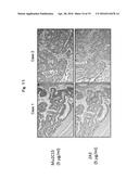 REAGENT INCLUDING ANTI-LGR6 ANTIBODIES FOR DETECTION AND DIAGNOSIS OF     CANCER diagram and image