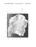 Optical Alignment System diagram and image