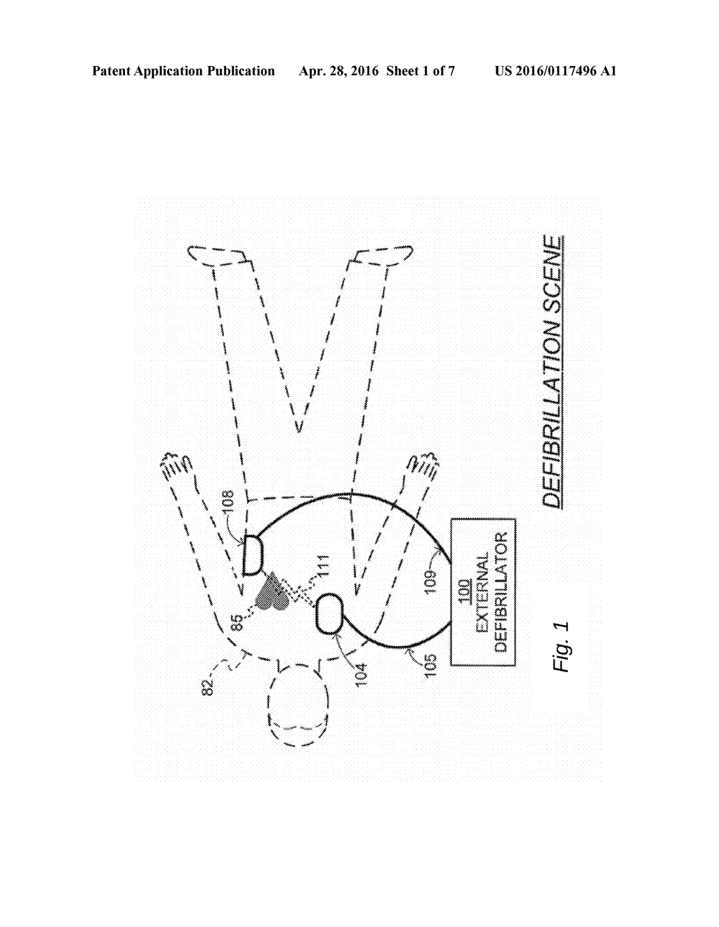 INTELLIGENT ACCESSORIES FOR MEDICAL DEVICES - diagram, schematic, and image 02