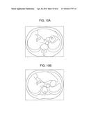 Image Processing Apparatus and Image Processing Method diagram and image