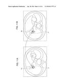 Image Processing Apparatus and Image Processing Method diagram and image