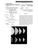 BREAST IMAGING REPORTING AND DATA SYSTEM (BI-RADS) TISSUE COMPOSITION diagram and image