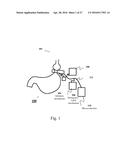 APPARATUS AND METHODS FOR CORRECTIVE GUIDANCE OF EATING BEHAVIOR AFTER     WEIGHT LOSS SURGERY diagram and image