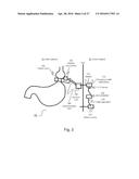 APPARATUS AND METHODS FOR CORRECTIVE GUIDANCE OF EATING BEHAVIOR AFTER     WEIGHT LOSS SURGERY diagram and image