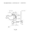 APPARATUS AND METHODS FOR CORRECTIVE GUIDANCE OF EATING BEHAVIOR AFTER     WEIGHT LOSS SURGERY diagram and image