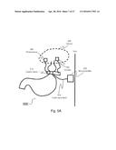 APPARATUS AND METHODS FOR CORRECTIVE GUIDANCE OF EATING BEHAVIOR AFTER     WEIGHT LOSS SURGERY diagram and image