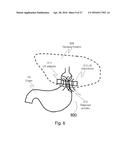 APPARATUS AND METHODS FOR CORRECTIVE GUIDANCE OF EATING BEHAVIOR AFTER     WEIGHT LOSS SURGERY diagram and image