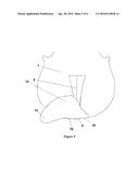 Chinrest for Stringed Instruments diagram and image