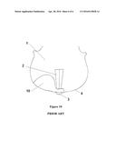 Chinrest for Stringed Instruments diagram and image