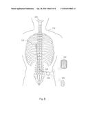 IMPLANT CURRENT CONTROLLED BATTERY CHARGING BASED ON TEMPERATURE diagram and image