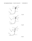 FOOTLET diagram and image