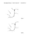 FOOTLET diagram and image