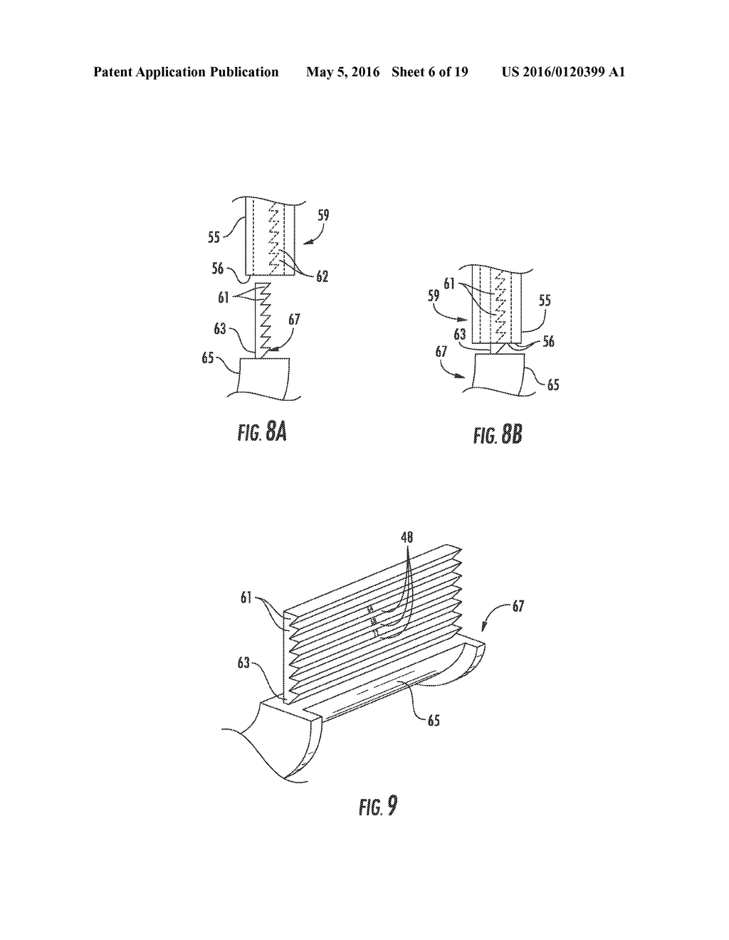 ADJUSTABLE BITE BLOCKS - diagram, schematic, and image 07