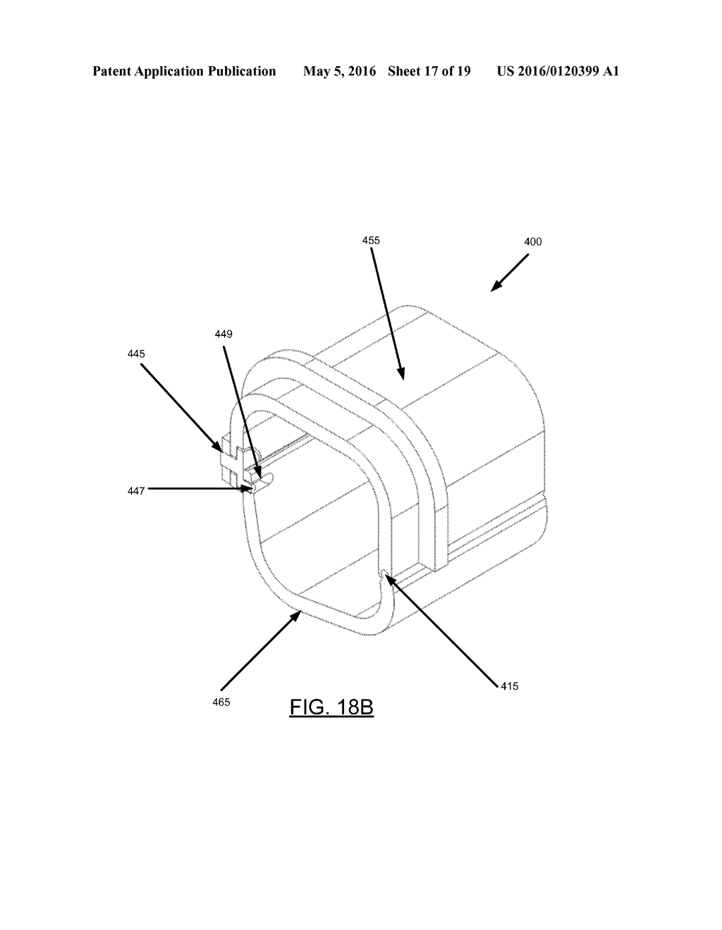 ADJUSTABLE BITE BLOCKS - diagram, schematic, and image 18