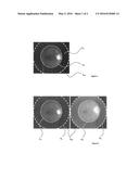 METHOD FOR REALIZING OCULAR FUNDUS PHOTOGRAPHS THAT ARE CORRECTED FOR     SCATTERED LIGHT diagram and image