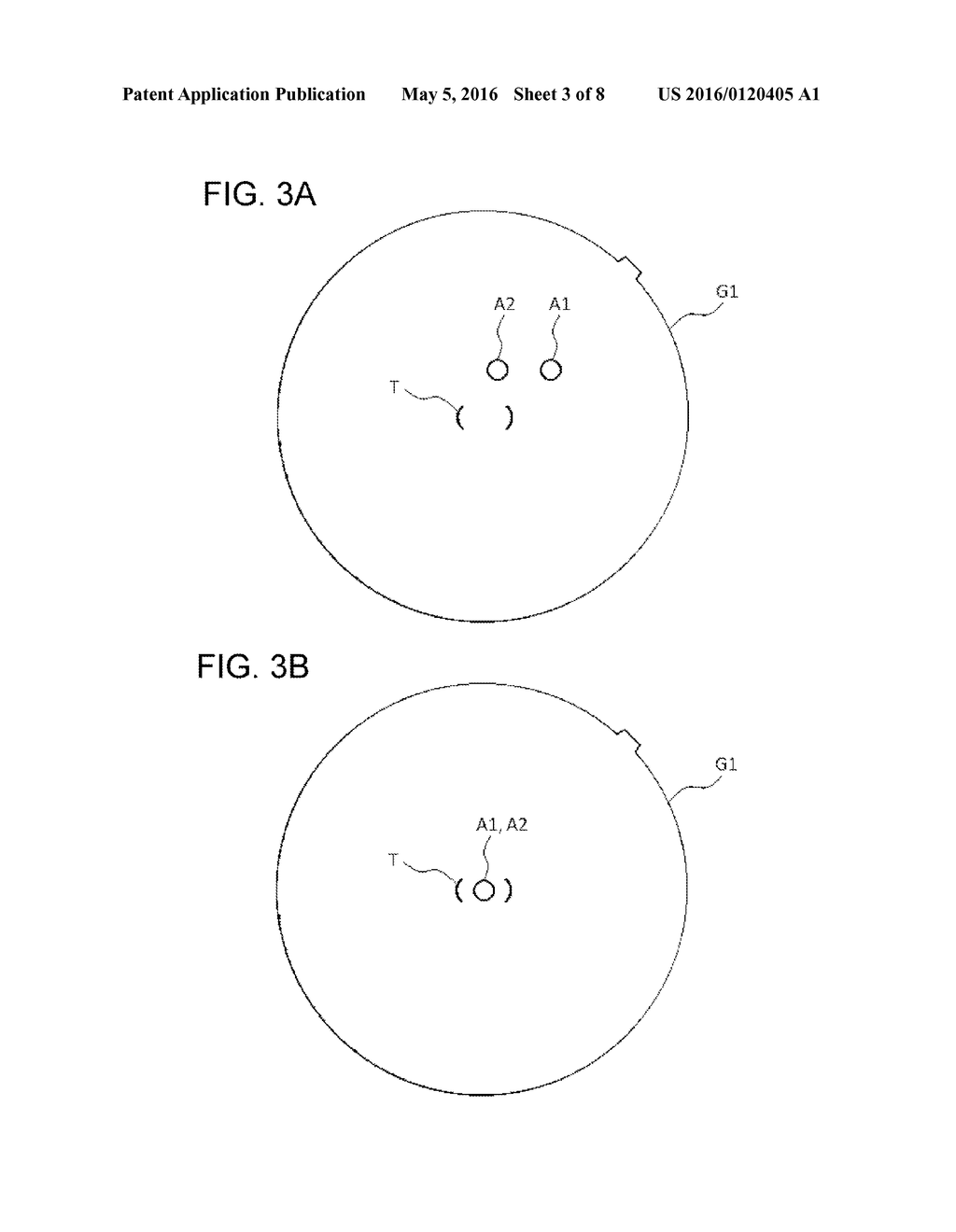 OPHTHALMOLOGIC APPARATUS - diagram, schematic, and image 04