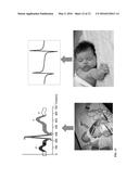 PASSIVE METHOD AND SYSTEM FOR CONTACT AND/OR NON-CONTACT WITH OR WITHOUT     INTERVENING MATERIALS FOR DETECTION AND IDENTIFICATION OF THE INCIDENCE,     TRAVERSE AND PHYSIOLOGICAL CONDITION OF A LIVING HUMAN AT ANY INSTANT diagram and image