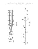 SYSTEM AND METHOD FOR FFR GUIDEWIRE RECOVERY diagram and image