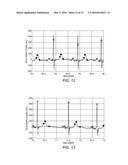 MEDICAL DEVICE HAVING AUTOMATED ECG FEATURE EXTRACTION diagram and image