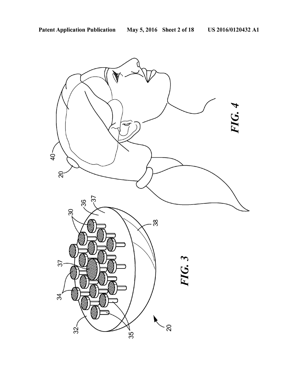 Sensor System and Process for Measuring Electric Activity of the Brain,     Including Electric Field Encephalography - diagram, schematic, and image 03