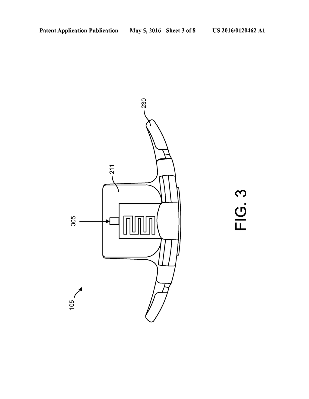 ORAL APPLIANCE FOR VENTILATION FLOW MEASUREMENT - diagram, schematic, and image 04