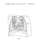 MEASURING MYOCARDIAL PHYSIOLOGIC PARAMETERS diagram and image