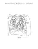 MEASURING MYOCARDIAL PHYSIOLOGIC PARAMETERS diagram and image