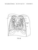 MEASURING MYOCARDIAL PHYSIOLOGIC PARAMETERS diagram and image