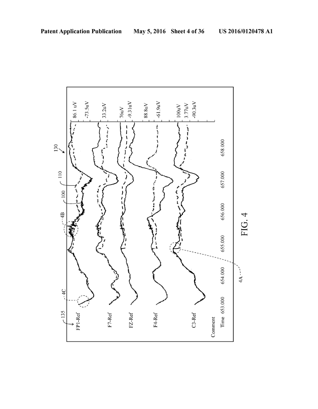 User Interface For Artifact Removal In An EEG - diagram, schematic, and image 05