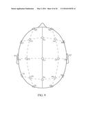 User Interface For Artifact Removal In An EEG diagram and image