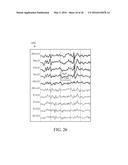 User Interface For Artifact Removal In An EEG diagram and image