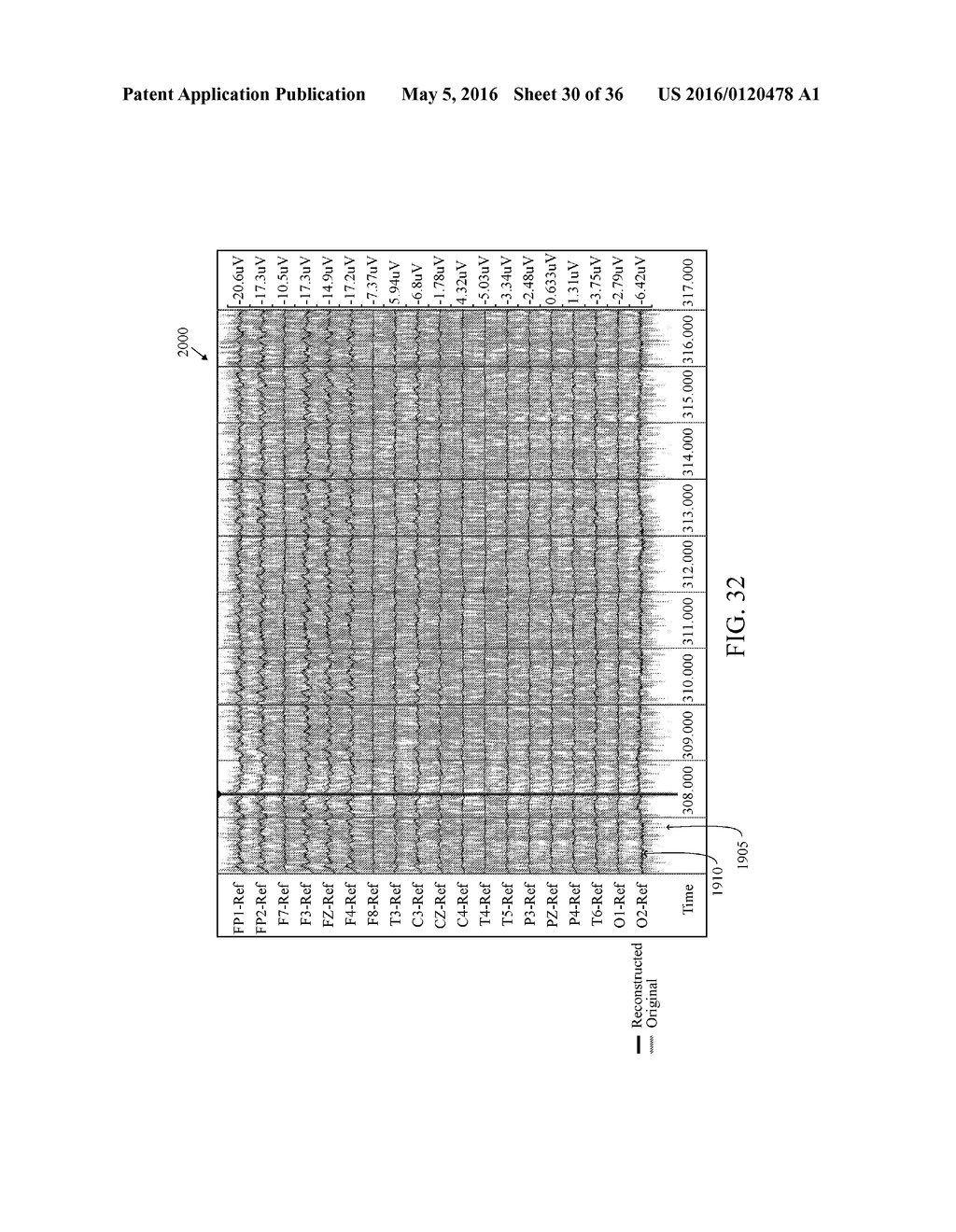 User Interface For Artifact Removal In An EEG - diagram, schematic, and image 31