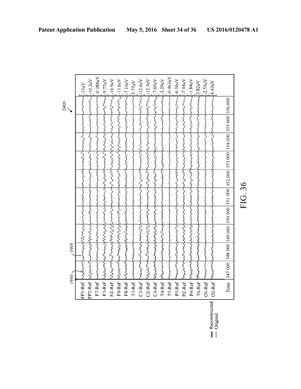 User Interface For Artifact Removal In An EEG - diagram, schematic, and image 35