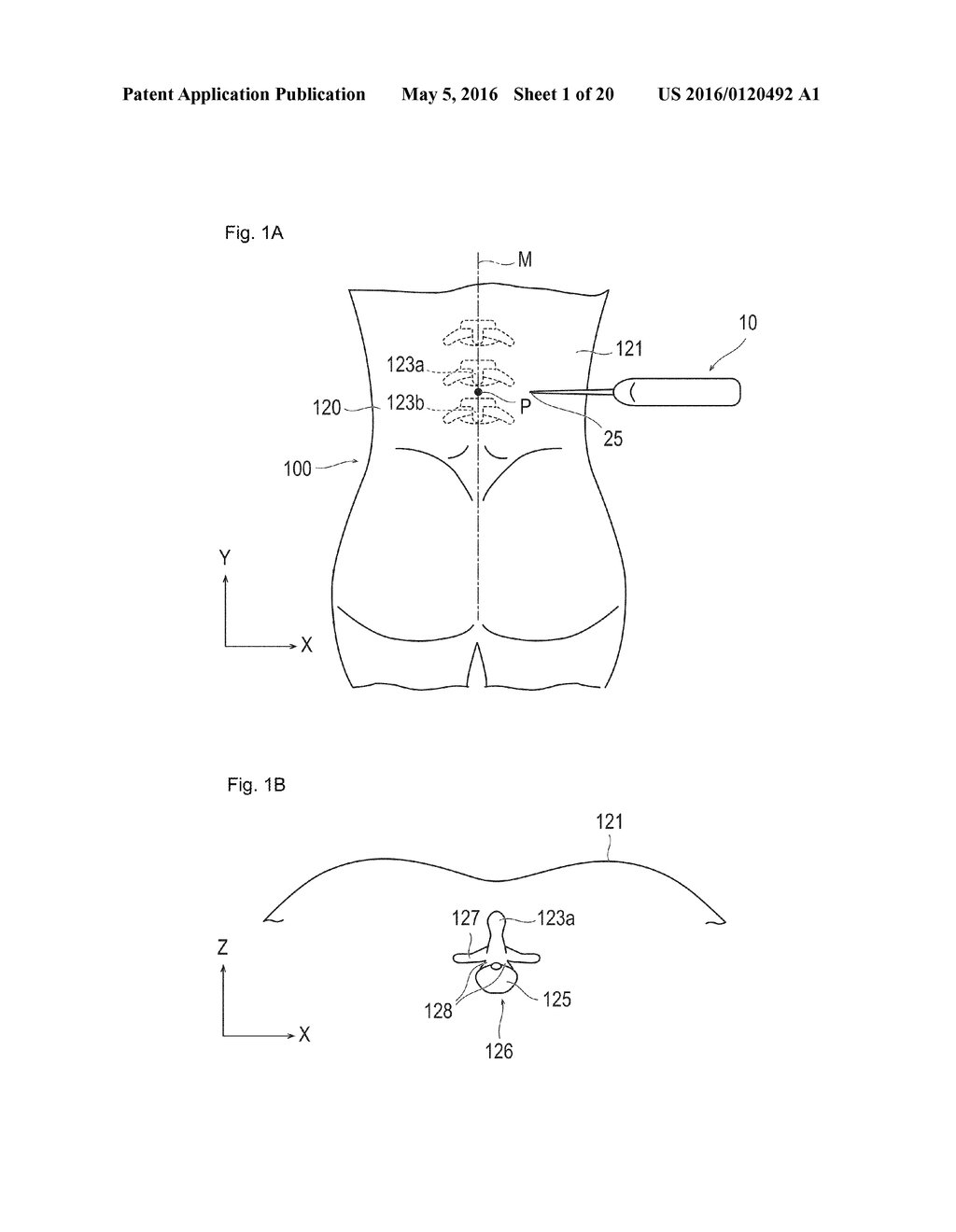 FILLING MATERIAL AND METHOD OF CONFIRMING INJECTION STATE OF FILLING     MATERIAL - diagram, schematic, and image 02