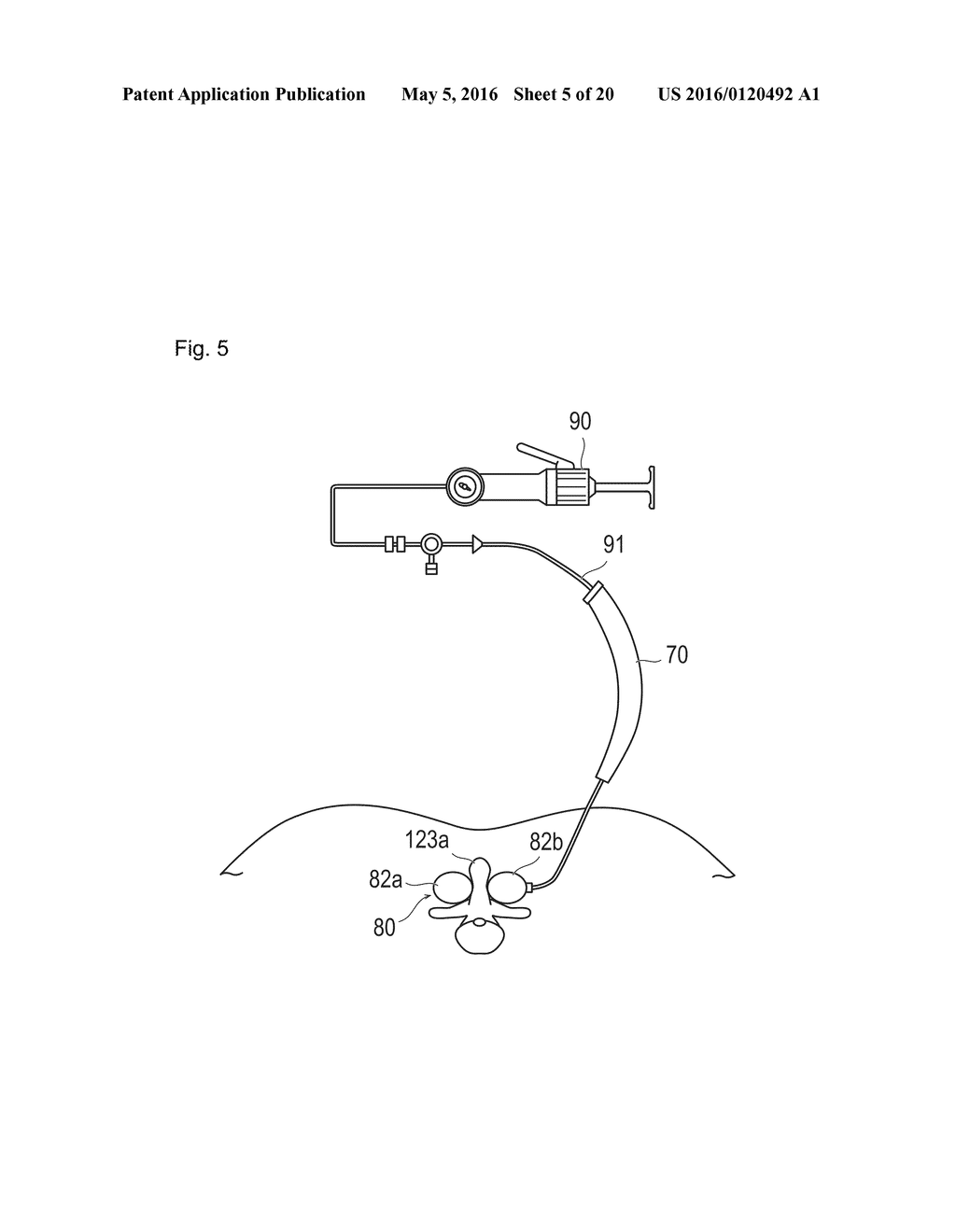 FILLING MATERIAL AND METHOD OF CONFIRMING INJECTION STATE OF FILLING     MATERIAL - diagram, schematic, and image 06