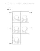 ULTRASOUND IMAGING APPARATUS AND METHOD OF OPERATING SAME diagram and image