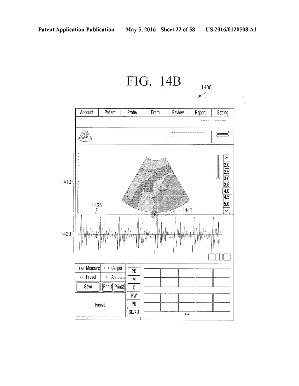 ULTRASOUND DIAGNOSIS APPARATUS AND CONTROL METHOD THEREOF - diagram, schematic, and image 23