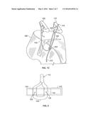 TISSUE REPAIR DEVICE diagram and image