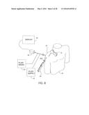 MEDICAL IMPLANT DELIVERY SYSTEM AND RELATED METHODS diagram and image