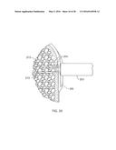 MEDICAL IMPLANT DELIVERY SYSTEM AND RELATED METHODS diagram and image