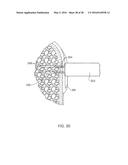 MEDICAL IMPLANT DELIVERY SYSTEM AND RELATED METHODS diagram and image