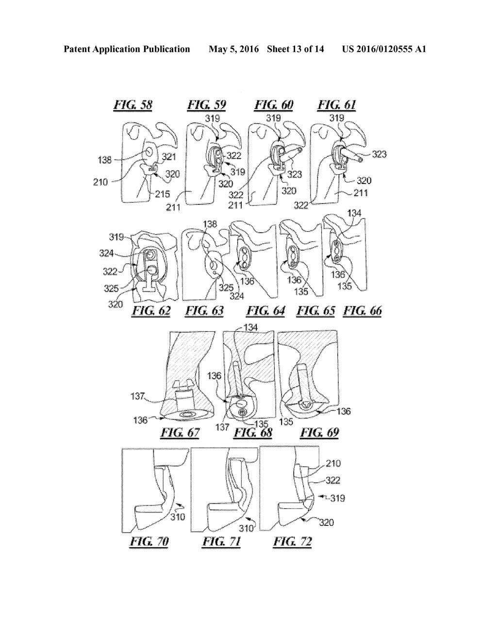 METHODS AND DEVICES FOR INSTALLING STANDARD AND REVERSE SHOULDER IMPLANTS - diagram, schematic, and image 14