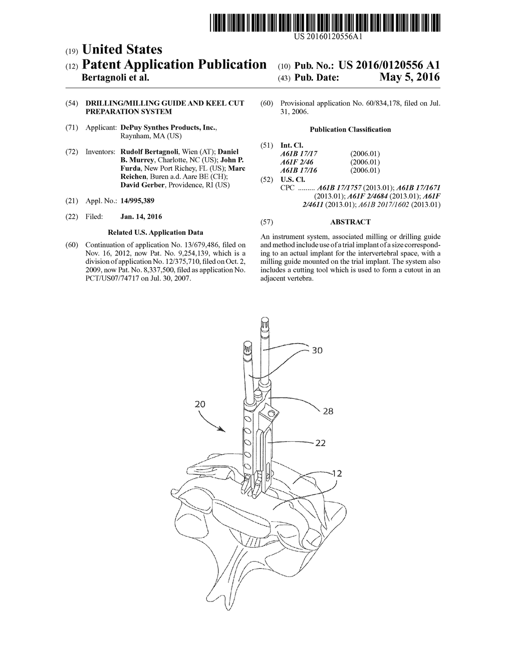 Drilling/Milling Guide and Keel Cut Preparation System - diagram, schematic, and image 01