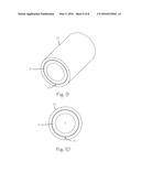 METHOD OF PROVIDING FOR THE MINIMIZATION OF EXTRAVASATION DURING     ARTHROSCOPIC SURGERY diagram and image