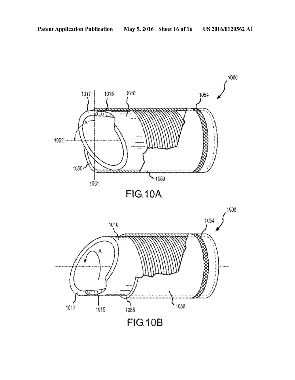 RETRACTABLE SEPARATING SYSTEMS AND METHODS - diagram, schematic, and image 17