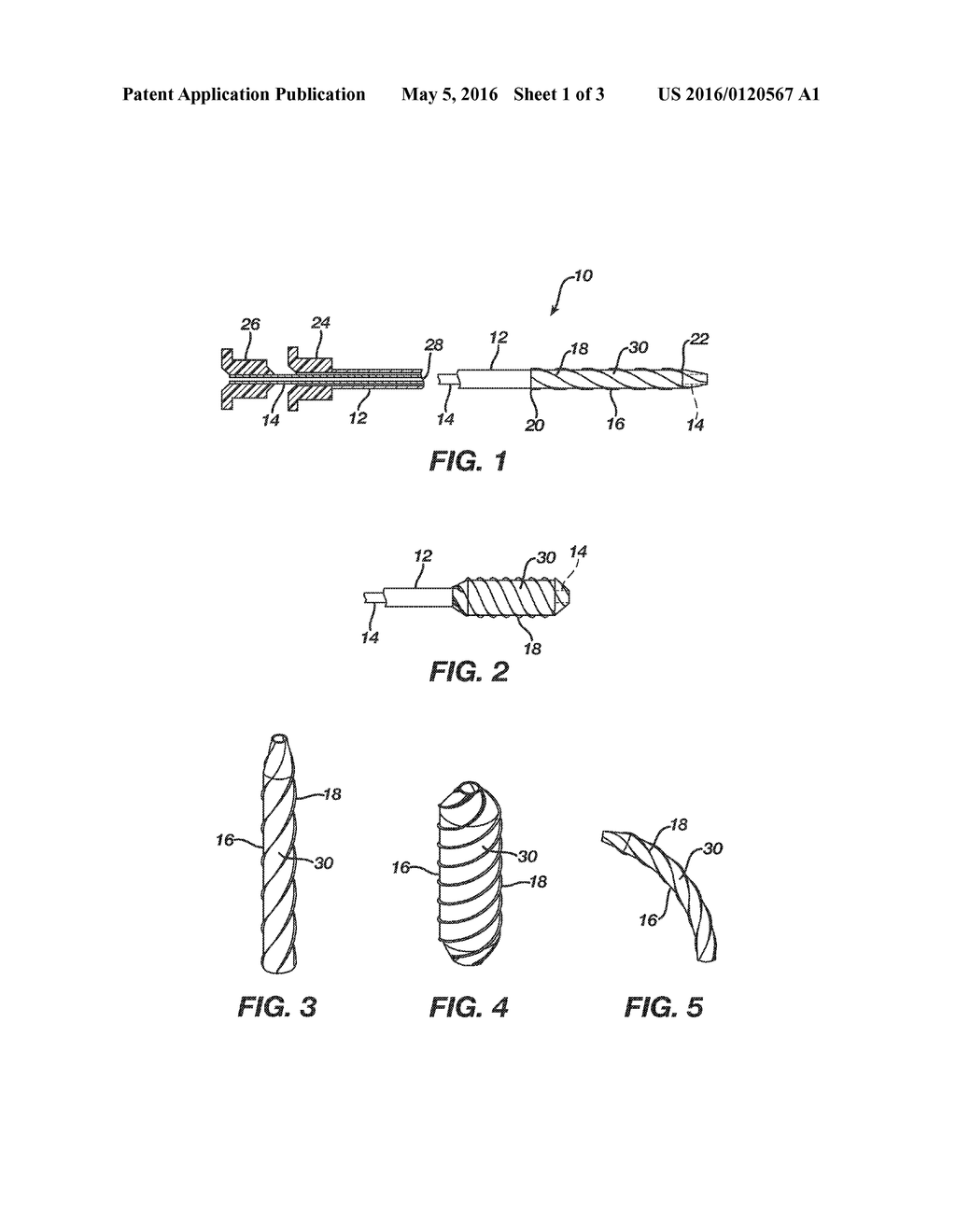 SYSTEM AND METHOD FOR DILATING AND ADJUSTING FLEXIBILITY IN A GUIDING     DEVICE - diagram, schematic, and image 02