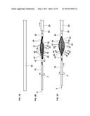 MEDICAL DEVICE AND TREATMENT METHOD diagram and image