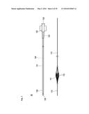 MEDICAL DEVICE AND TREATMENT METHOD diagram and image