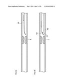 MEDICAL DEVICE AND TREATMENT METHOD diagram and image